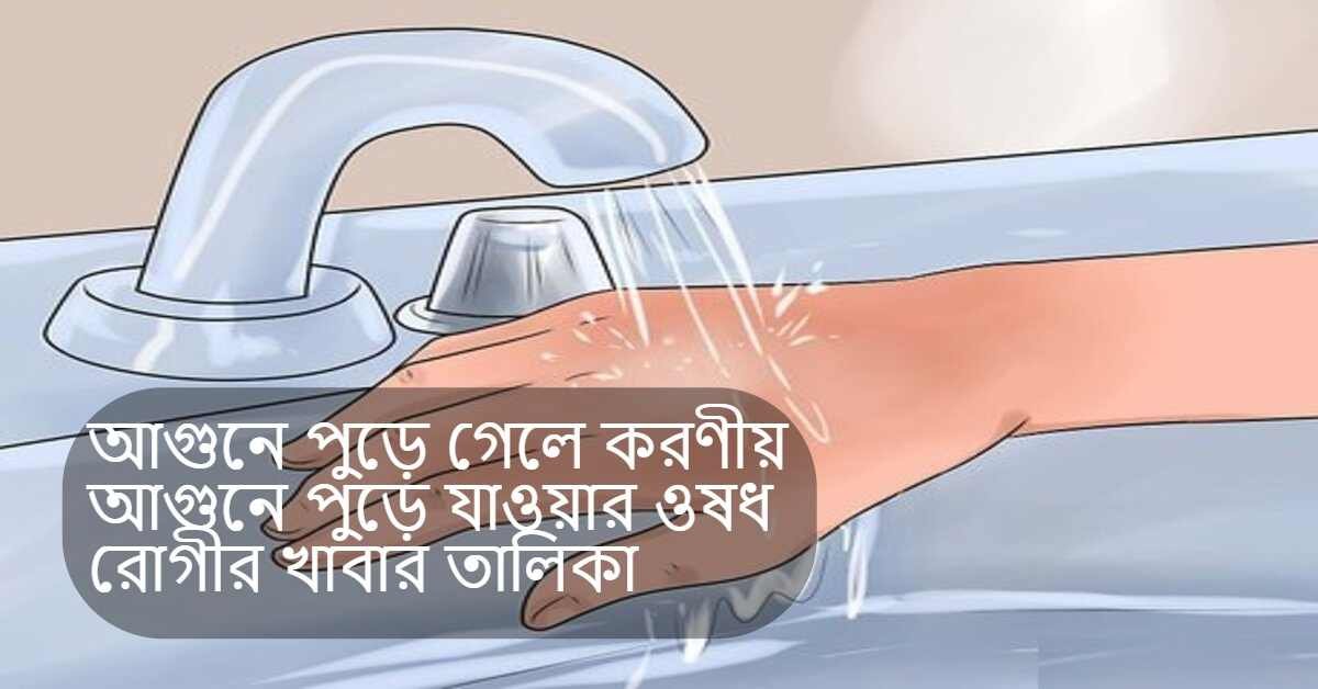 আগুনে পুড়ে গেলে করণীয়